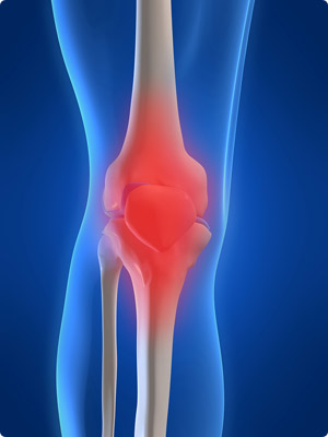 Osteopaths Treat Leg and Arm Pain